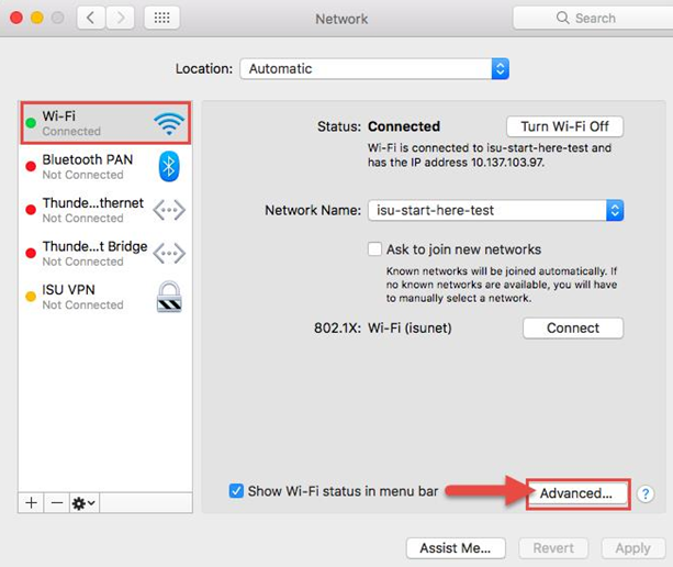 Advanced button in Network preferences